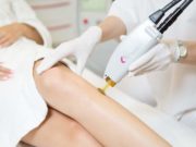 Вредна ли лазерная эпиляция