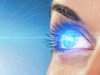 Лазерная коррекция зрения методом Lasik: основные достоинства