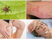 Как передается болезнь Лайма?