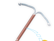 Особенности установкивнутриматочной спирали Юнона