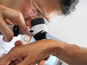 Лечение меланомы глаза в Израиле: современные технологии