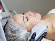 Ультразвуковой SMAS-лифтинг :очень популярная процедура в современной косметологии