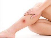 Что такое трофические язвы?