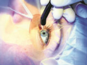 Центр микрохирургии глаза «Окулюс» в Липецке: преимущества