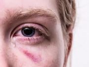 Воспаление глаз: типы, причины, симптомы, лечение