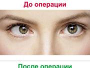 К какому врачу обратиться при подозрении на косоглазие