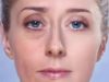 Как убрать мешки под глазами — скульптура лица за час?