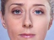 Как убрать мешки под глазами — скульптура лица за час?