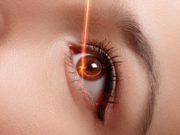 Лазерная коррекция зрения: как проходит операция?