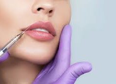 Контурная пластика губ: что нужно знать о процедуре