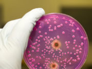 Анализ посев на микоплазму