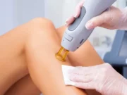 Что представляет собой Александритовая эпиляция?