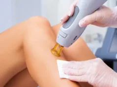 Что представляет собой Александритовая эпиляция?