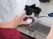 Показания и противопоказания к пункции фолликулов